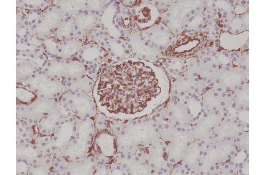 Immunohistochemistry - Anti-Vimentin Antibody [RM289] (A121369) - Antibodies.com