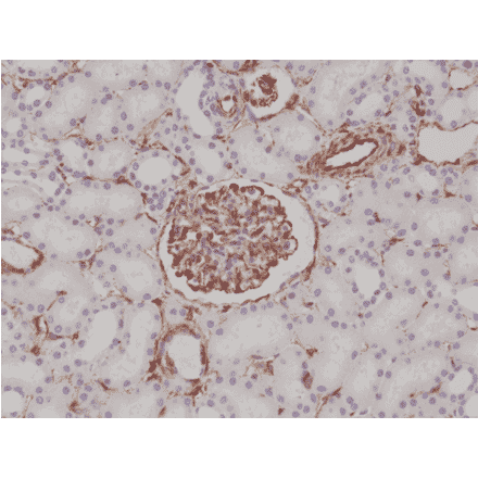 Immunohistochemistry - Anti-Vimentin Antibody [RM289] (A121369) - Antibodies.com