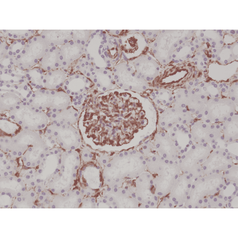 Immunohistochemistry - Anti-Vimentin Antibody [RM289] (A121369) - Antibodies.com