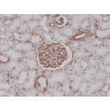 Immunohistochemistry - Anti-Vimentin Antibody [RM289] (A121369) - Antibodies.com