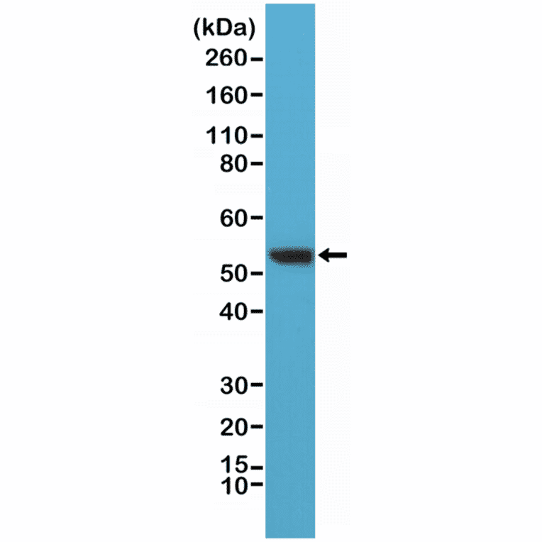Western Blot - Anti-Vimentin Antibody [RM289] (A121374) - Antibodies.com
