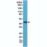 Western Blot - Anti-Vimentin Antibody [RM289] (A121374) - Antibodies.com