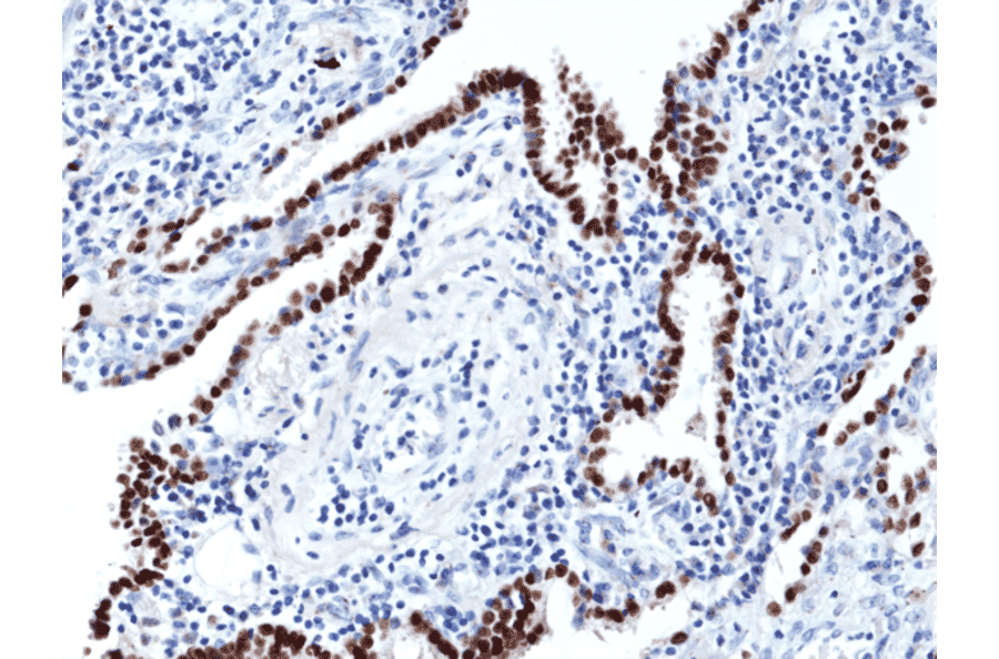 Immunohistochemistry - Anti-TTF1 Antibody [RM373] (A121489) - Antibodies.com
