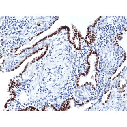 Immunohistochemistry - Anti-TTF1 Antibody [RM373] (A121489) - Antibodies.com