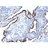 Immunohistochemistry - Anti-TTF1 Antibody [RM373] (A121489) - Antibodies.com