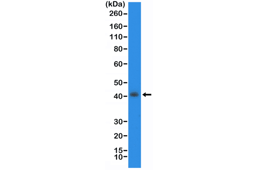 Western Blot - Anti-TTF1 Antibody [RM373] (A121375) - Antibodies.com