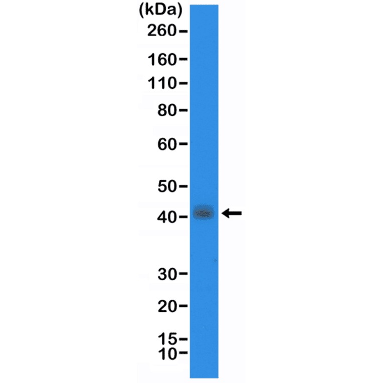 Western Blot - Anti-TTF1 Antibody [RM373] (A121375) - Antibodies.com