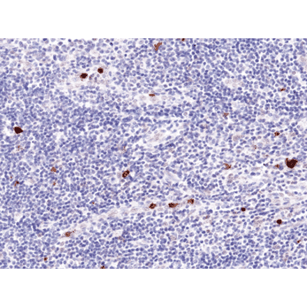 Immunohistochemistry - Anti-Myeloperoxidase Antibody [RM407] (A121428) - Antibodies.com