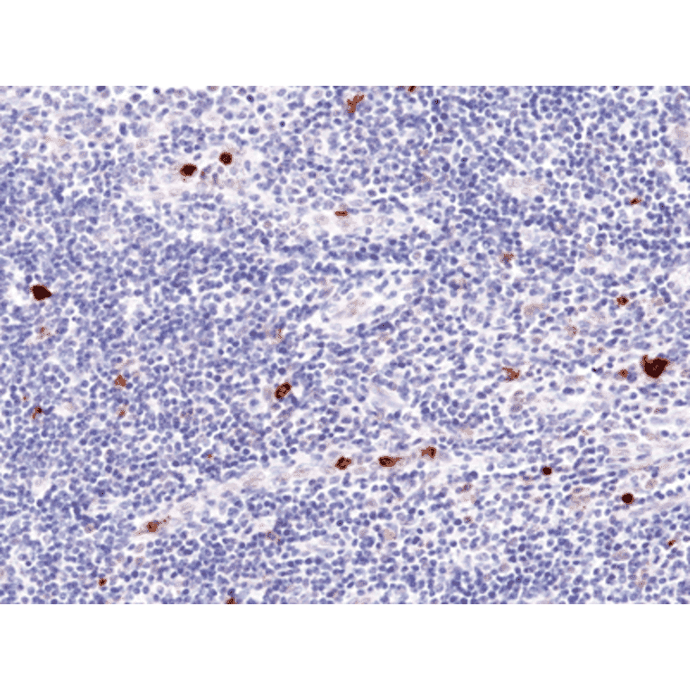 Immunohistochemistry - Anti-Myeloperoxidase Antibody [RM407] (A121428) - Antibodies.com
