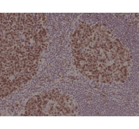 Immunohistochemistry - Anti-Stathmin 1 Antibody [RM350] (A121502) - Antibodies.com