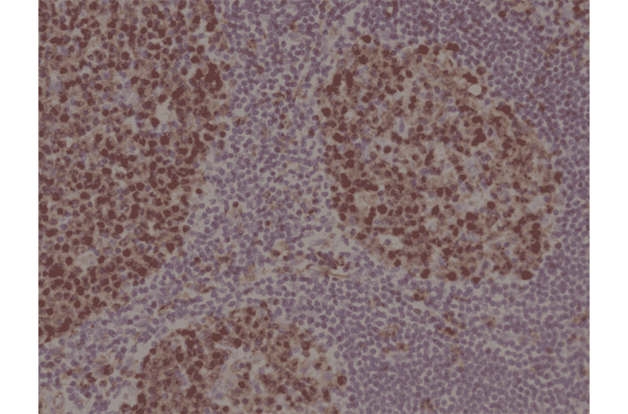 Immunohistochemistry - Anti-Stathmin 1 Antibody [RM350] (A121502) - Antibodies.com