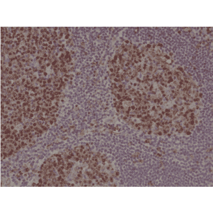Immunohistochemistry - Anti-Stathmin 1 Antibody [RM350] (A121502) - Antibodies.com