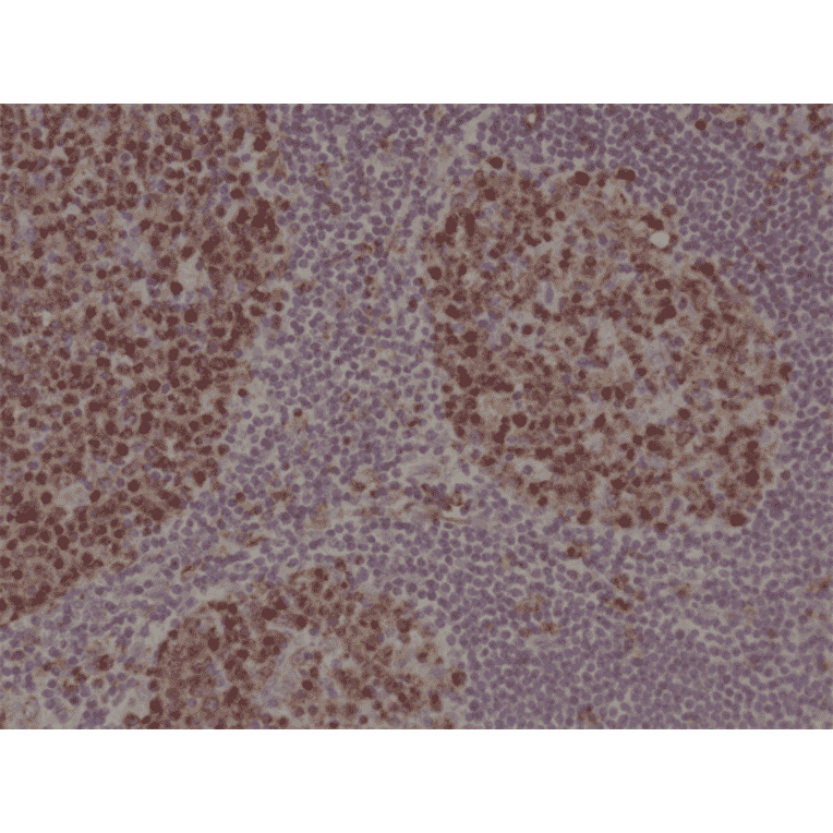 Immunohistochemistry - Anti-Stathmin 1 Antibody [RM350] (A121502) - Antibodies.com