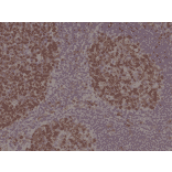 Immunohistochemistry - Anti-Stathmin 1 Antibody [RM350] (A121502) - Antibodies.com