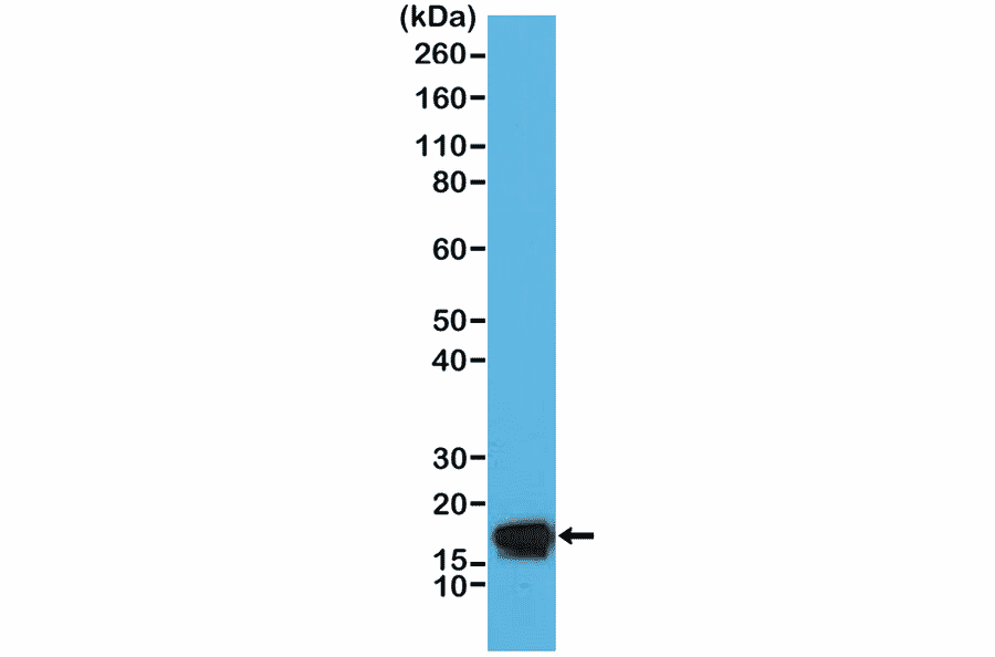 Western Blot - Anti-Stathmin 1 Antibody [RM350] (A121377) - Antibodies.com