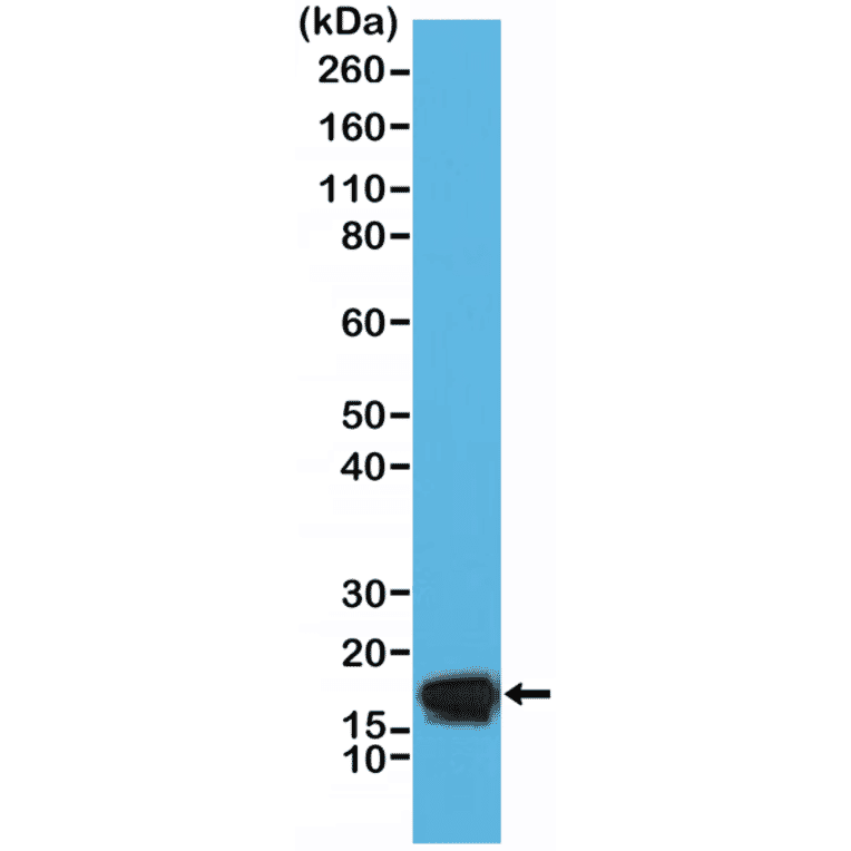 Western Blot - Anti-Stathmin 1 Antibody [RM350] (A121377) - Antibodies.com