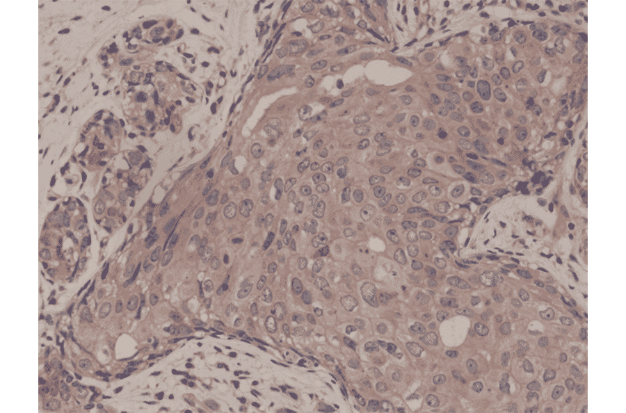 Immunohistochemistry - Anti-Smad4 Antibody [RM277] (A121393) - Antibodies.com