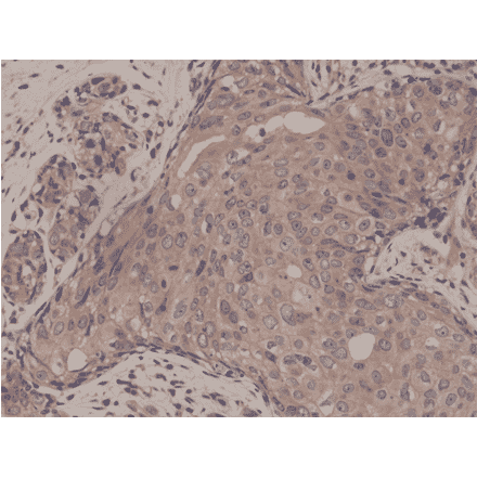 Immunohistochemistry - Anti-Smad4 Antibody [RM277] (A121393) - Antibodies.com