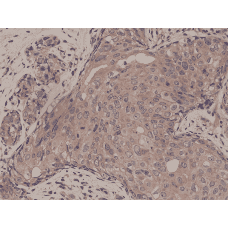 Immunohistochemistry - Anti-Smad4 Antibody [RM277] (A121393) - Antibodies.com
