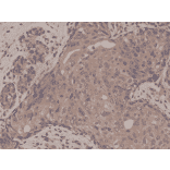 Immunohistochemistry - Anti-Smad4 Antibody [RM277] (A121393) - Antibodies.com