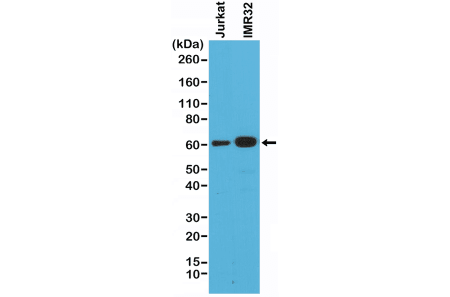 Western Blot - Anti-Smad4 Antibody [RM277] (A121378) - Antibodies.com