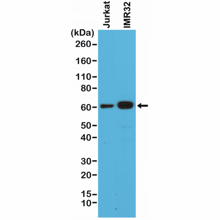 Western Blot - Anti-Smad4 Antibody [RM277] (A121378) - Antibodies.com