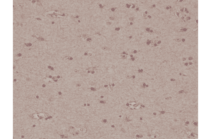 Immunohistochemistry - Anti-S100 beta Antibody [RM304] (A121379) - Antibodies.com