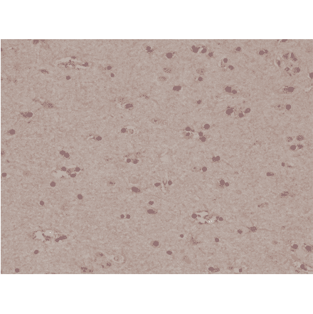 Immunohistochemistry - Anti-S100 beta Antibody [RM304] (A121379) - Antibodies.com