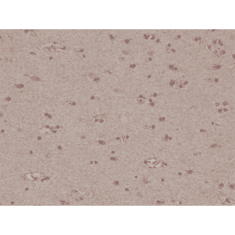 Immunohistochemistry - Anti-S100 beta Antibody [RM304] (A121379) - Antibodies.com