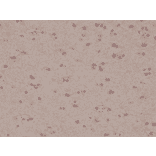 Immunohistochemistry - Anti-S100 beta Antibody [RM304] (A121379) - Antibodies.com