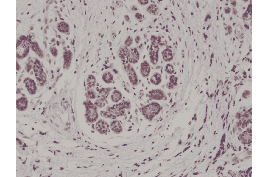 Immunohistochemistry - Anti-S100 beta Antibody [RM304] (A121441) - Antibodies.com