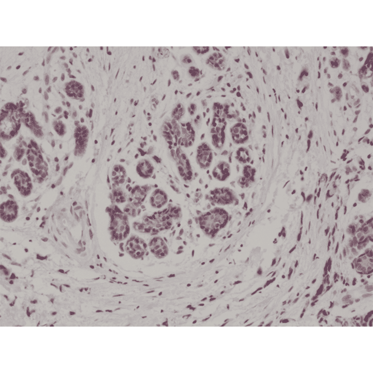Immunohistochemistry - Anti-S100 beta Antibody [RM304] (A121441) - Antibodies.com