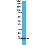 Western Blot - Anti-S100 beta Antibody [RM304] (A121379) - Antibodies.com