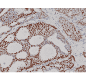 Immunohistochemistry - Anti-Progesterone Receptor Antibody [RM357] (A121507) - Antibodies.com