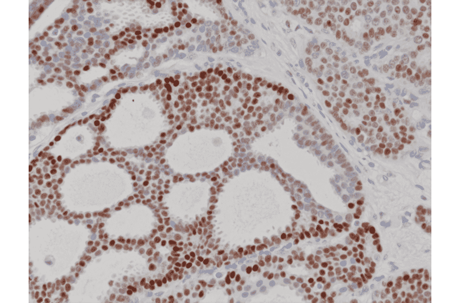 Immunohistochemistry - Anti-Progesterone Receptor Antibody [RM357] (A121507) - Antibodies.com