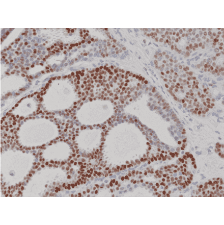 Immunohistochemistry - Anti-Progesterone Receptor Antibody [RM357] (A121507) - Antibodies.com