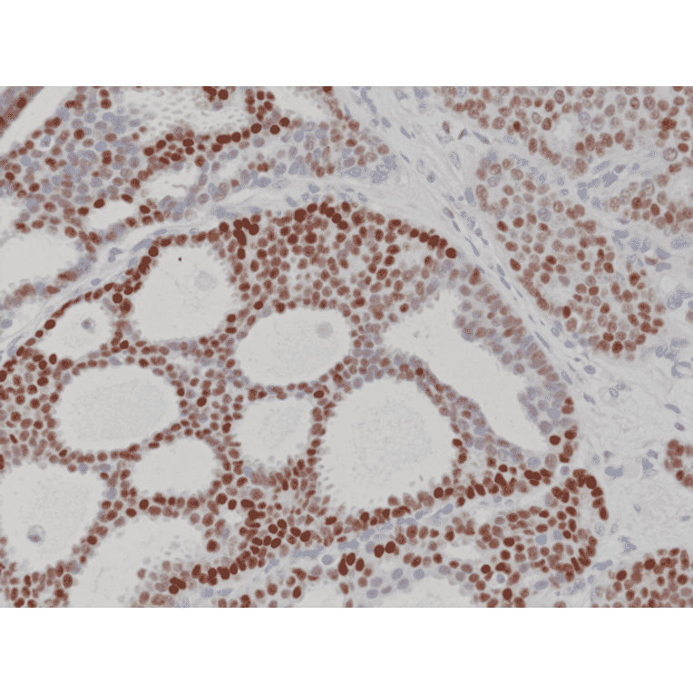 Immunohistochemistry - Anti-Progesterone Receptor Antibody [RM357] (A121507) - Antibodies.com