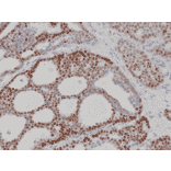 Immunohistochemistry - Anti-Progesterone Receptor Antibody [RM357] (A121507) - Antibodies.com