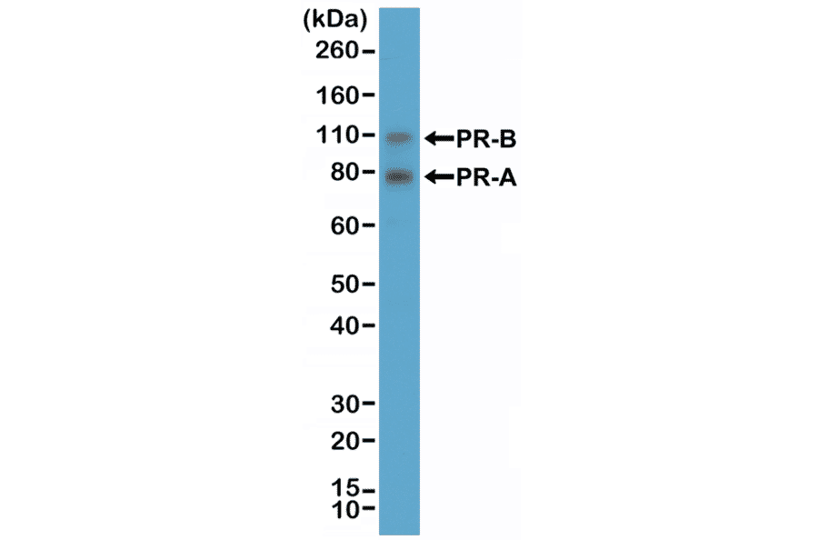 Western Blot - Anti-Progesterone Receptor Antibody [RM357] (A121380) - Antibodies.com