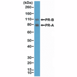 Western Blot - Anti-Progesterone Receptor Antibody [RM357] (A121380) - Antibodies.com