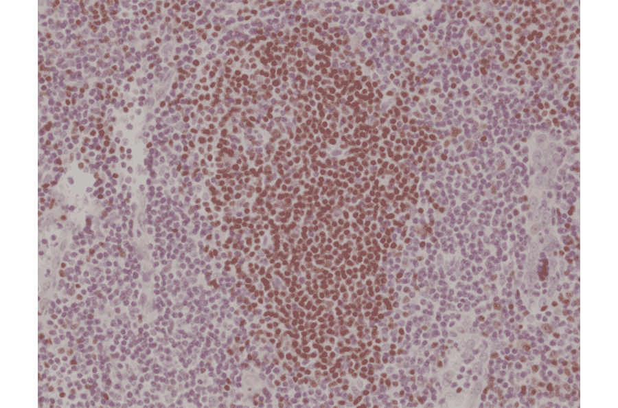Immunohistochemistry - Anti-PAX5 Antibody [RM331] (A121477) - Antibodies.com