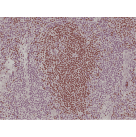 Immunohistochemistry - Anti-PAX5 Antibody [RM331] (A121477) - Antibodies.com