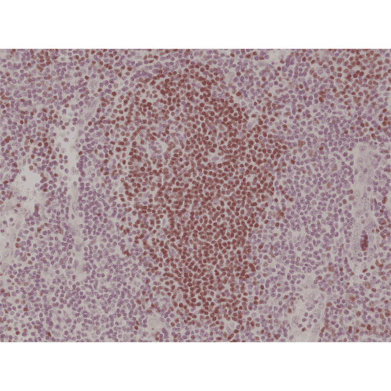 Immunohistochemistry - Anti-PAX5 Antibody [RM331] (A121477) - Antibodies.com