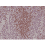 Immunohistochemistry - Anti-PAX5 Antibody [RM331] (A121477) - Antibodies.com