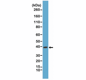 Western Blot - Anti-p38 MAPK Antibody [RM245] (A121383) - Antibodies.com