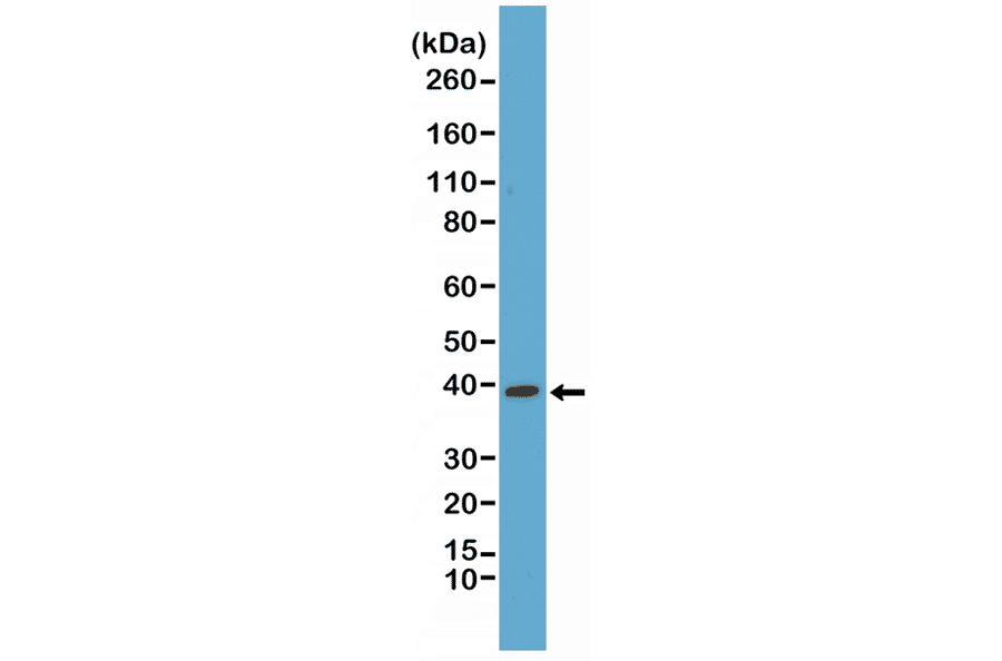 Western Blot - Anti-p38 MAPK Antibody [RM245] (A121383) - Antibodies.com