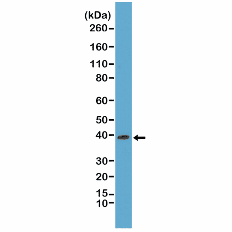 Western Blot - Anti-p38 MAPK Antibody [RM245] (A121383) - Antibodies.com