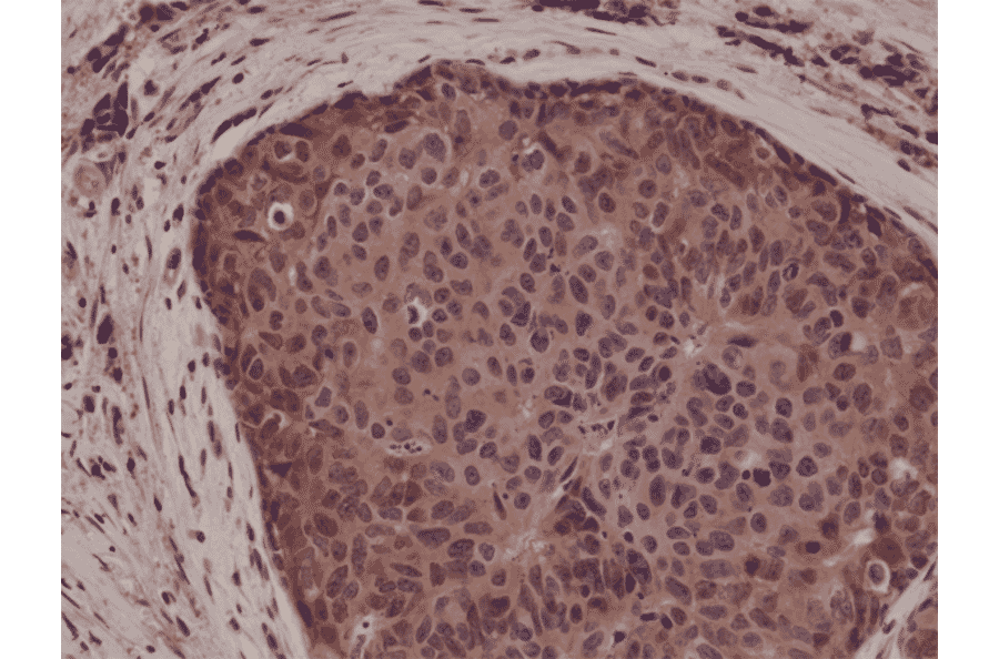 Immunohistochemistry - Anti-p38 MAPK Antibody [RM245] (A121194) - Antibodies.com