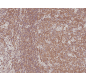 Immunohistochemistry - Anti-NFkB p105 / p50 Antibody [RM299] (A121245) - Antibodies.com