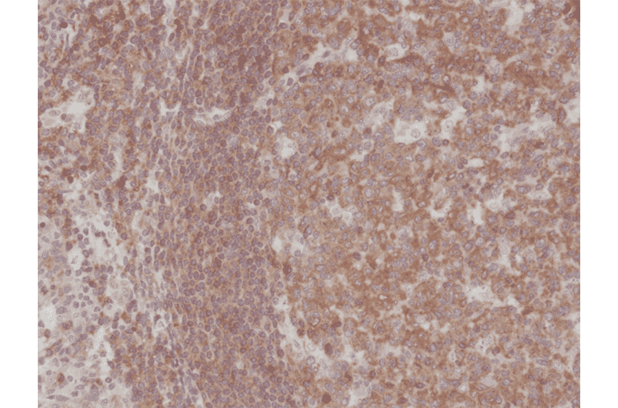 Immunohistochemistry - Anti-NFkB p105 / p50 Antibody [RM299] (A121245) - Antibodies.com